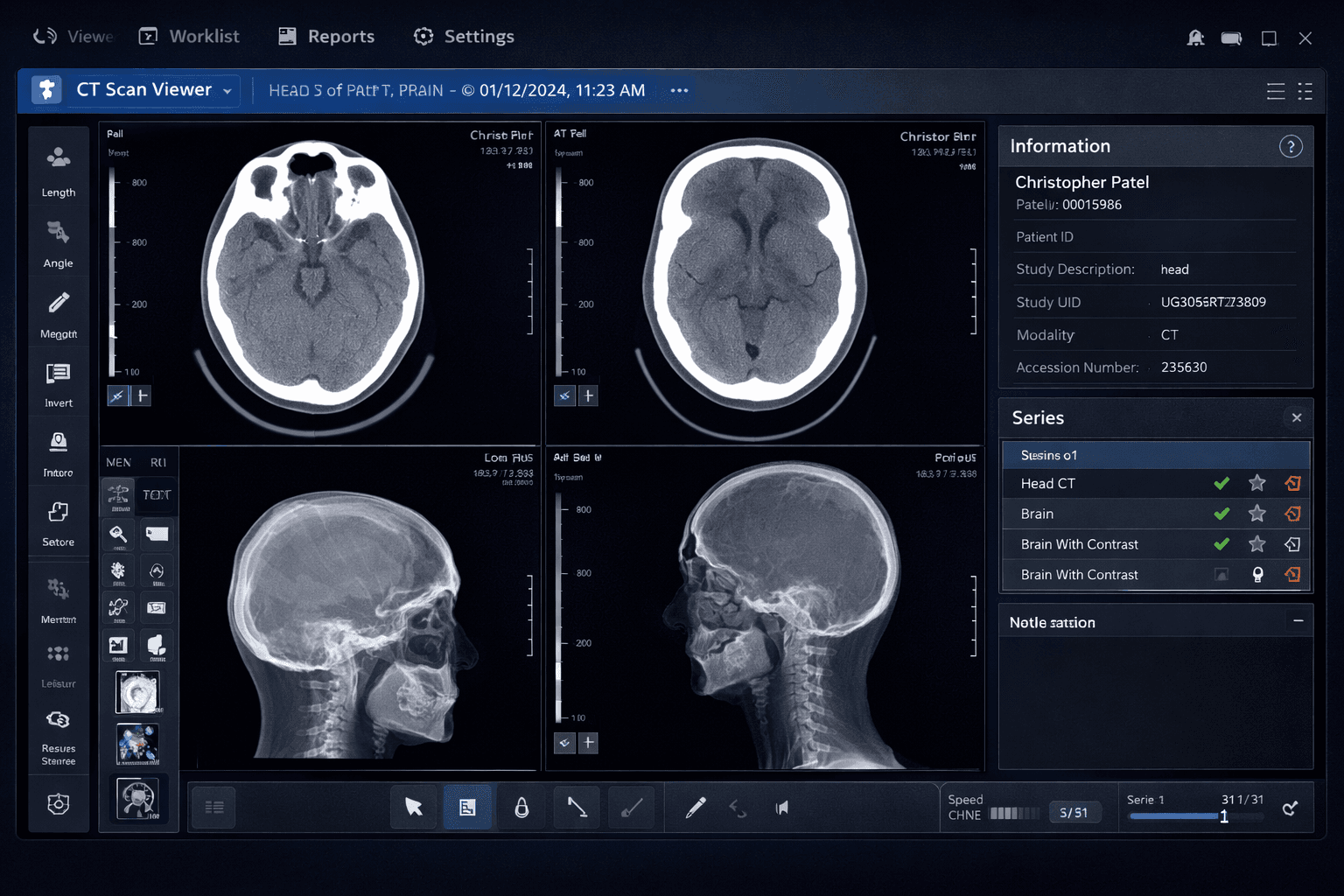 MedDream DICOM Viewer — CT Scan multi-panel diagnostic view